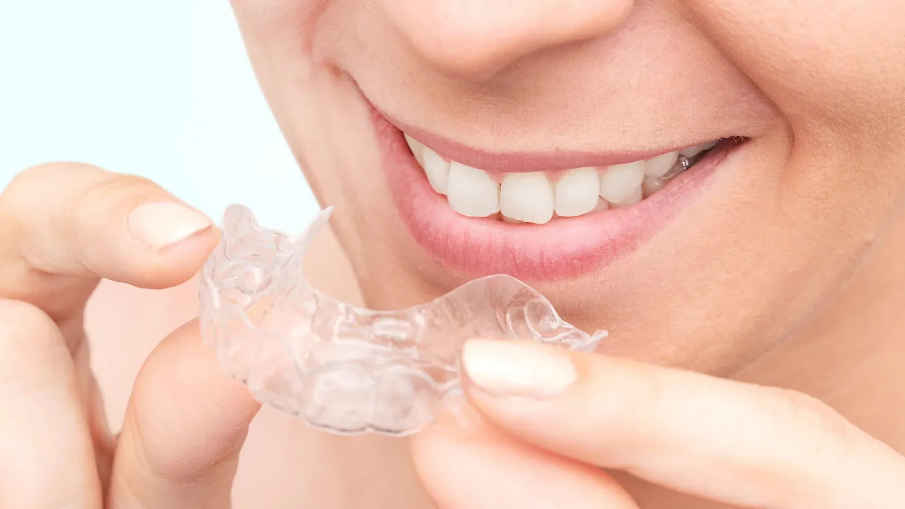 Custom Nightguards at Alta Vista Dental Care